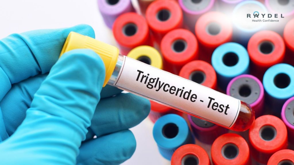 Chỉ số Triglyceride cao bao nhiêu phải uống thuốc?