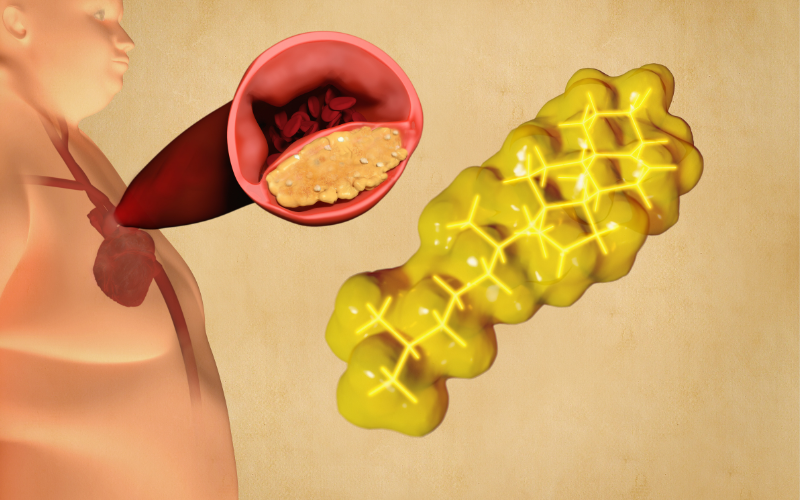 Triglyceride cao có thể gây nhiều biến chứng nguy hiểm
