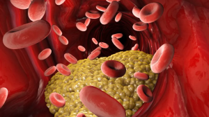 Chỉ số Triglyceride là gì? Cao bao nhiêu là nguy hiểm và 5 cách hạ hiệu quả