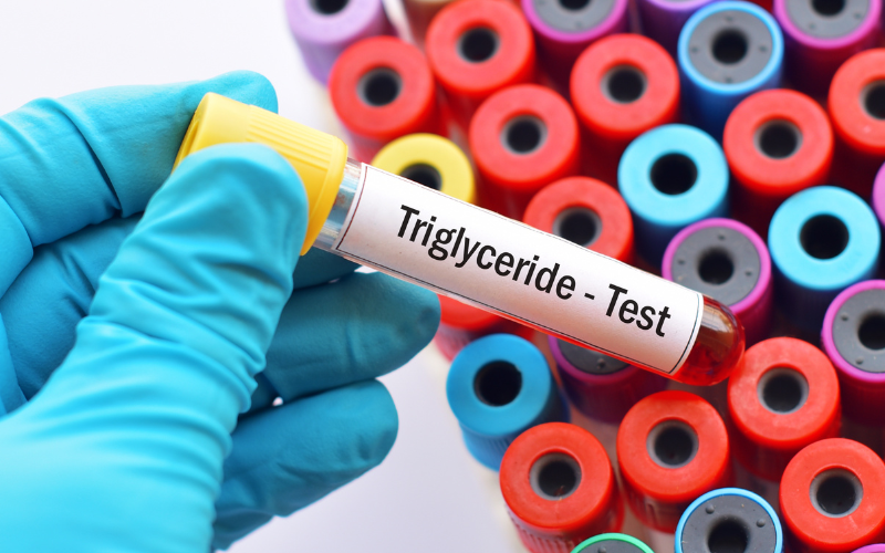 Chỉ số Triglyceride ở mức rất cao nên gặp bác sĩ để theo dõi