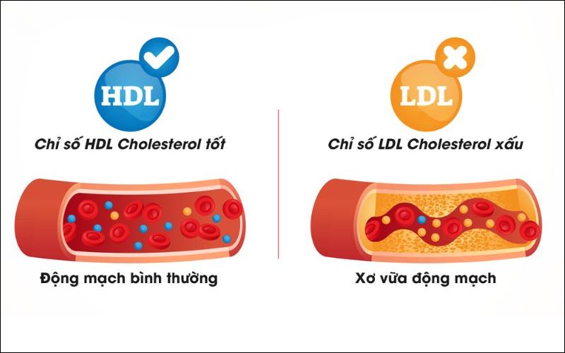 Các loại cholesterol trong máu
