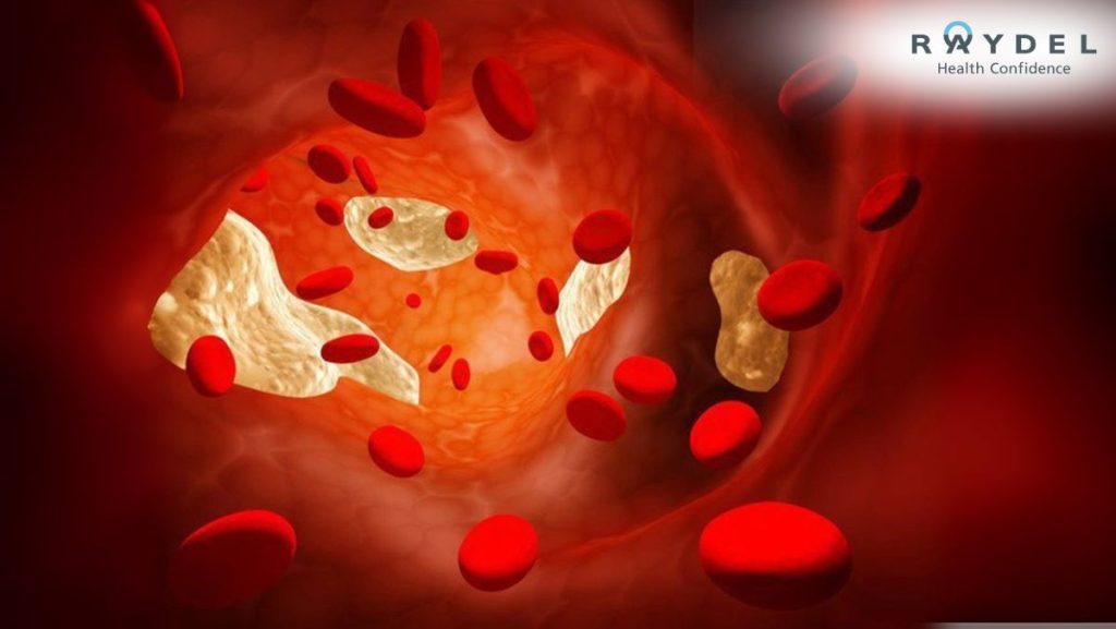 Cholesterol là gì?