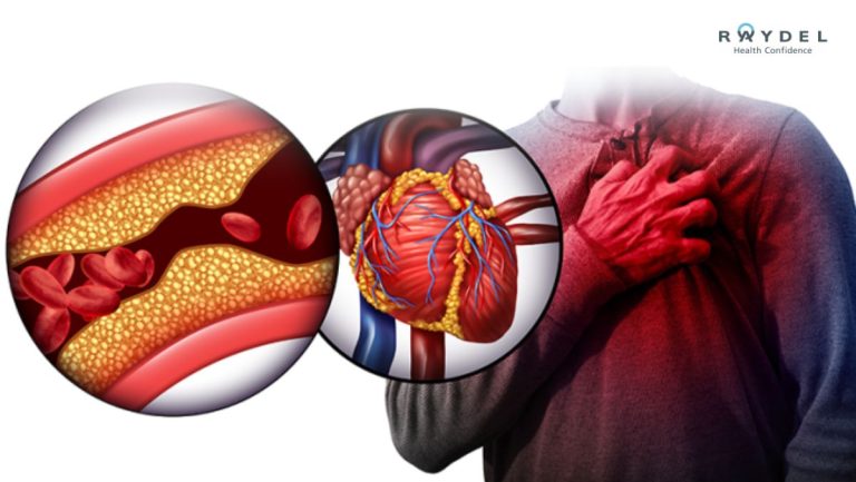10 Dấu hiệu rối loạn lipid máu và cách phòng ngừa hiệu quả