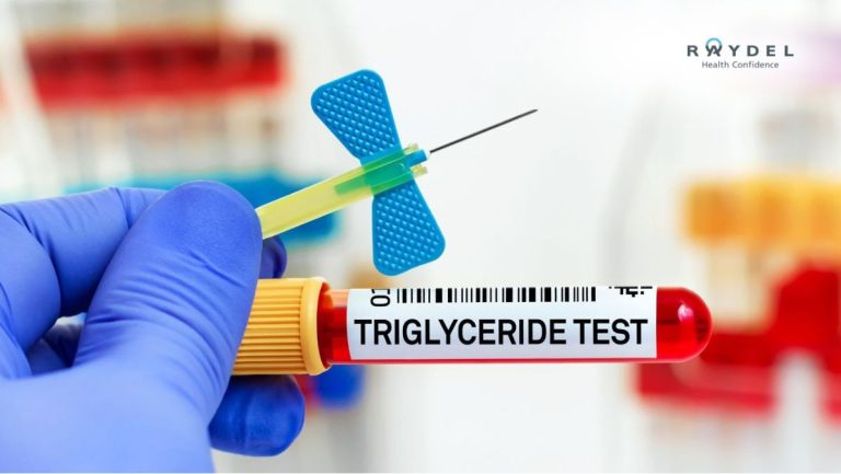 Triglyceride là gì? Cao bao nhiêu nguy hiểm, cách hạ tại nhà